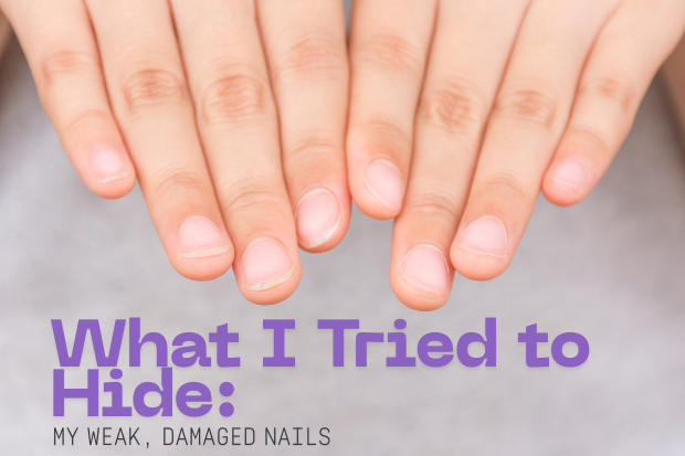 Can Nail Wraps Help Stop Nail Biting (or Protect Damaged Nails)?